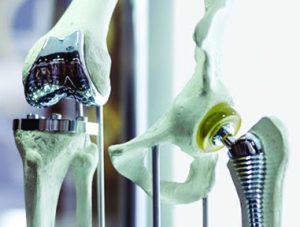 The benefits of PEEK Plastics in Implant Surgery - Tinius Olsen